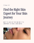 3 Ways to find the right skin expert for your skin journey